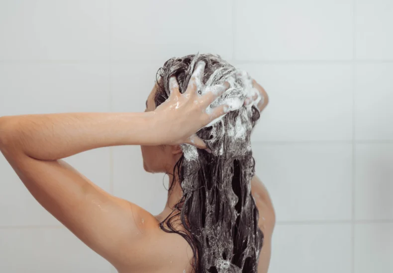 hair loss