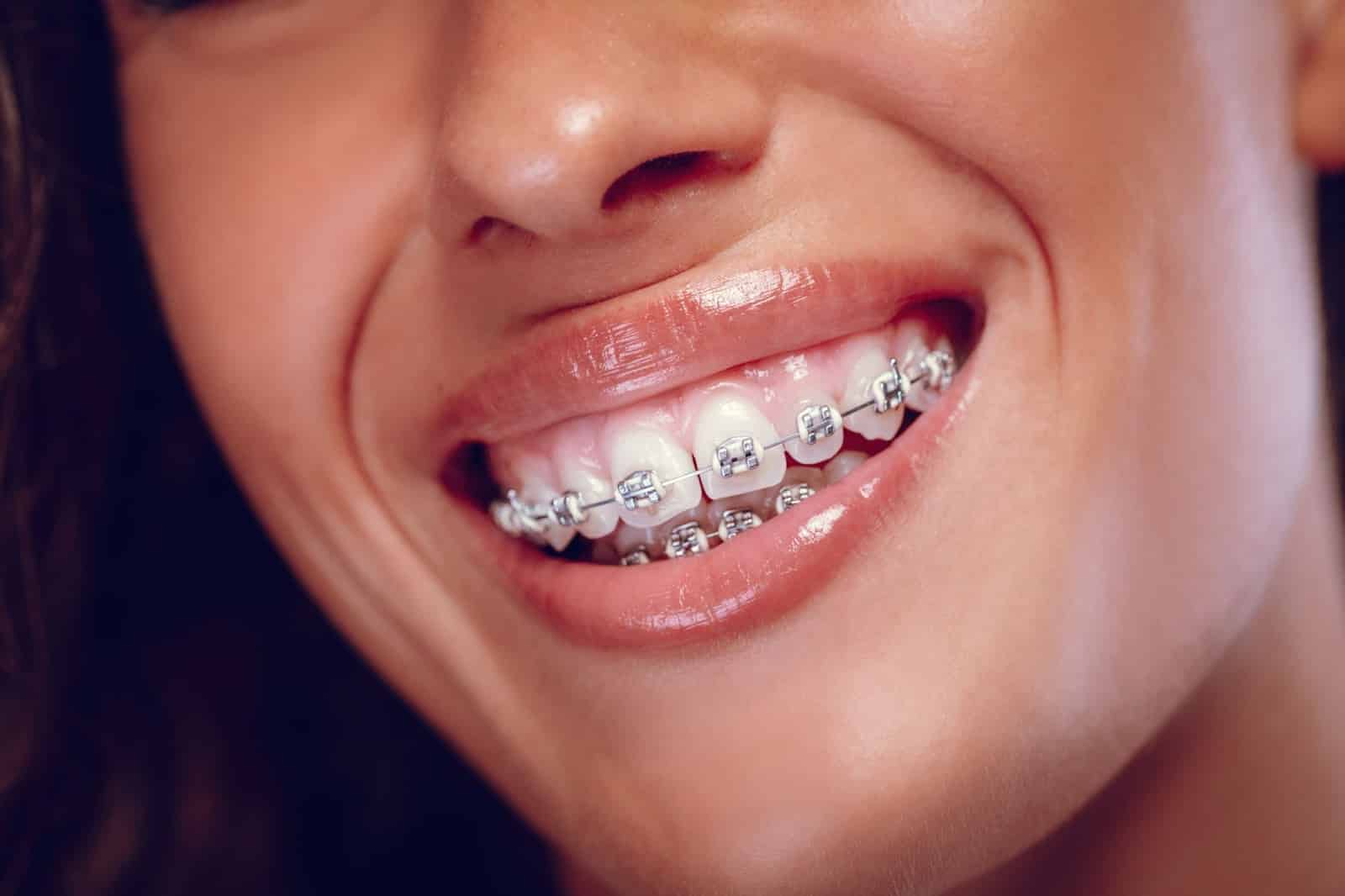 Dental